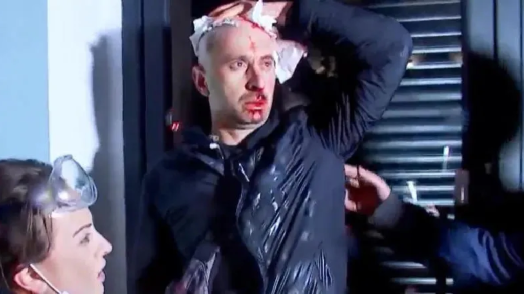 El periodista Guram Rogava, quien fue golpeado en la cabeza