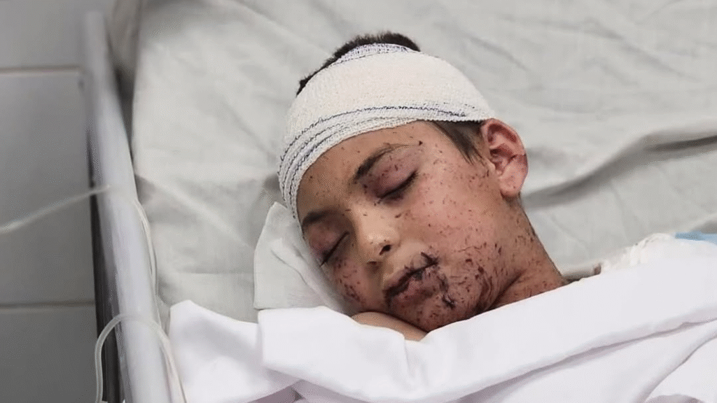 Adam al-Najjar, el único hijo que sobrevivió al ataque aéreo israelí que mató a sus nueve hermanos en Khan Younis, lucha por su vida en cuidados intensivos