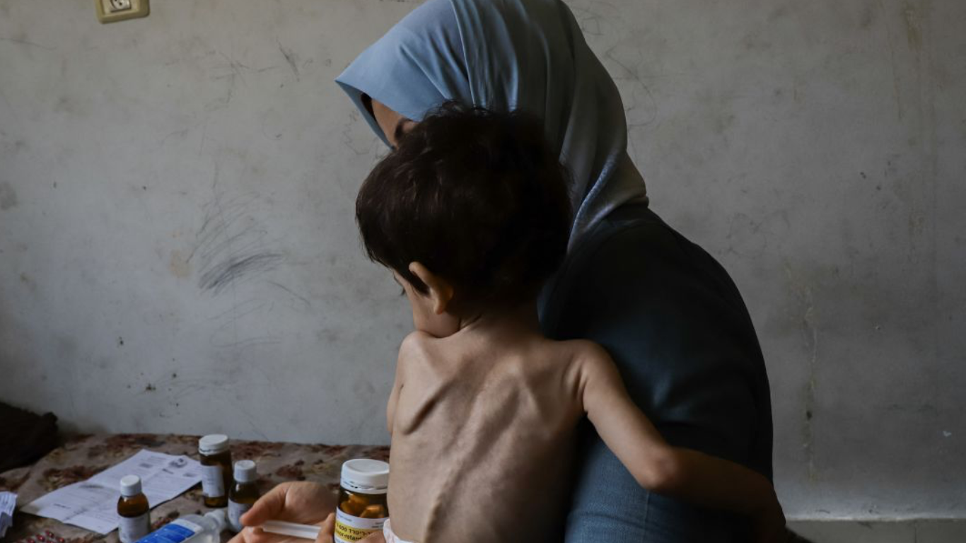 Al menos 66 niños palestinos han muerto por desnutrición en la Franja de Gaza, según informó este sábado la Oficina de Medios del Gobierno local
