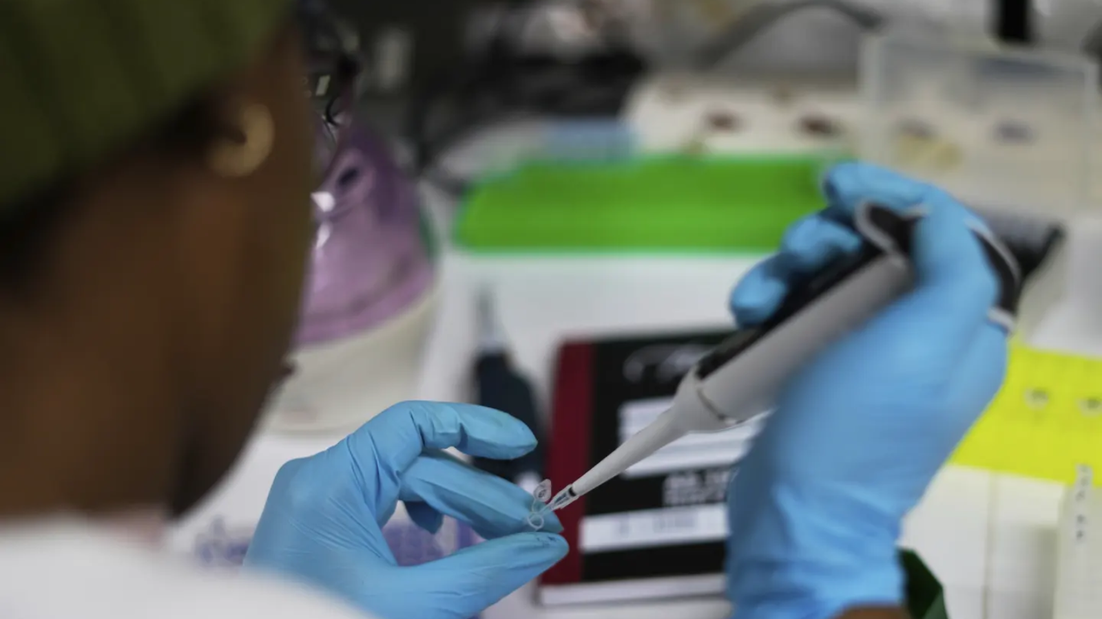 Recortes de ayuda de Estados Unidos detienen vacuna contra VIH en Sudáfrica