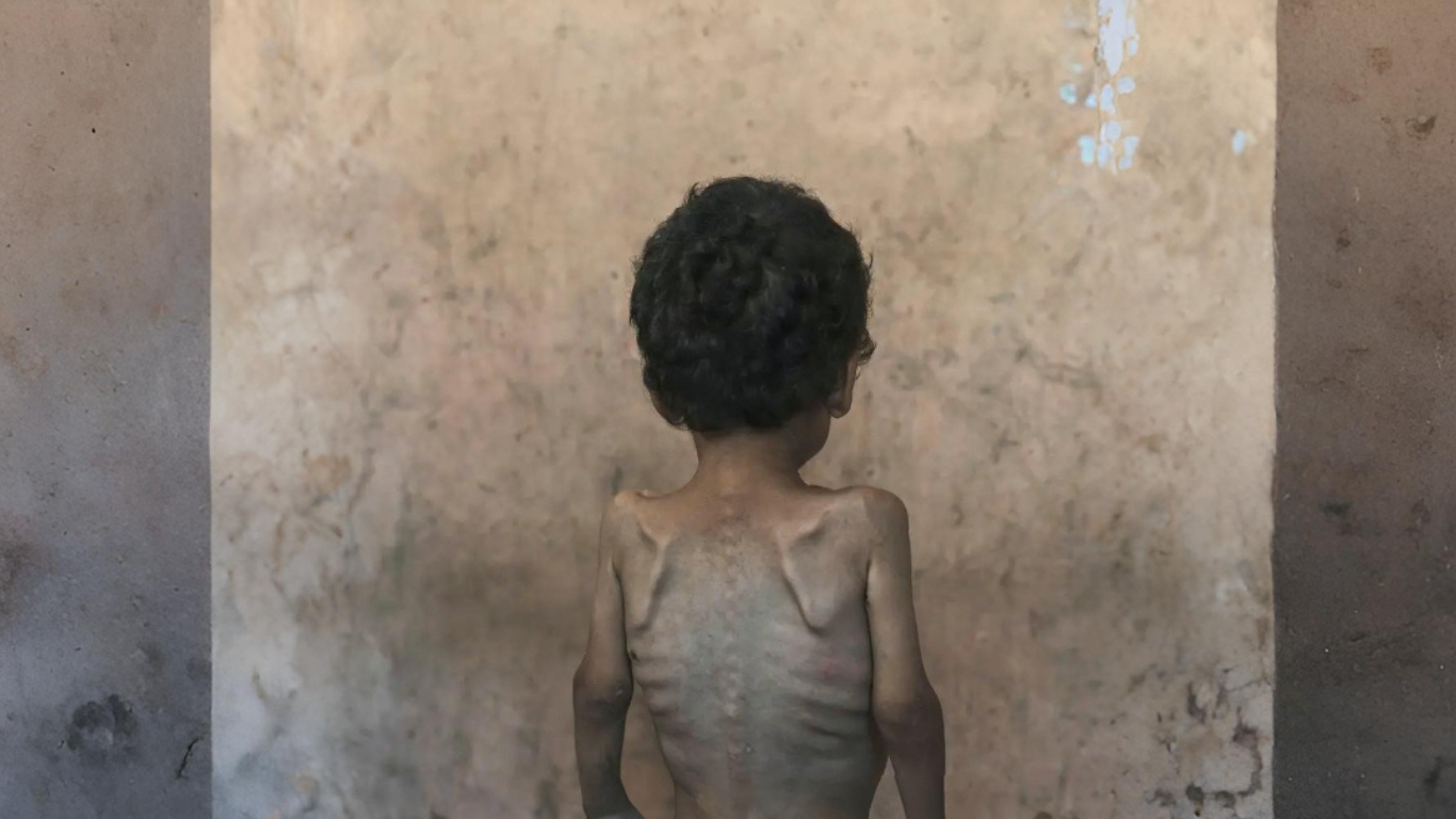 El peor escenario de hambruna se está desarrollando en Gaza, según un informe del IPC