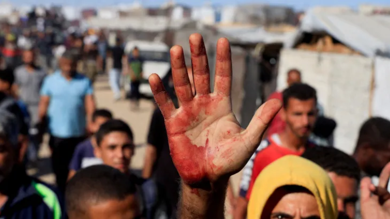 La hambruna impide donar sangre en Gaza