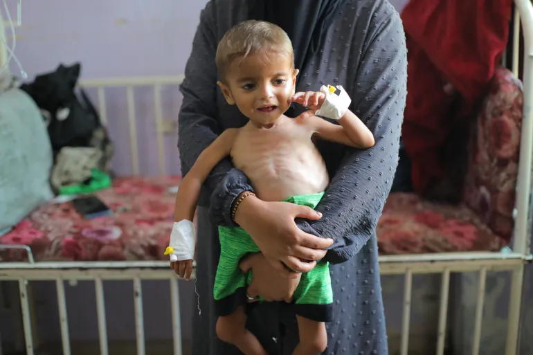 Un niño palestino que sufre desnutrición recibe tratamiento en el Hospital de los Mártires de Al-Aqsa en Deir el-Balah, Gaza, el 11 de agosto de 2025 [Hassan Jedi/Andadolu]