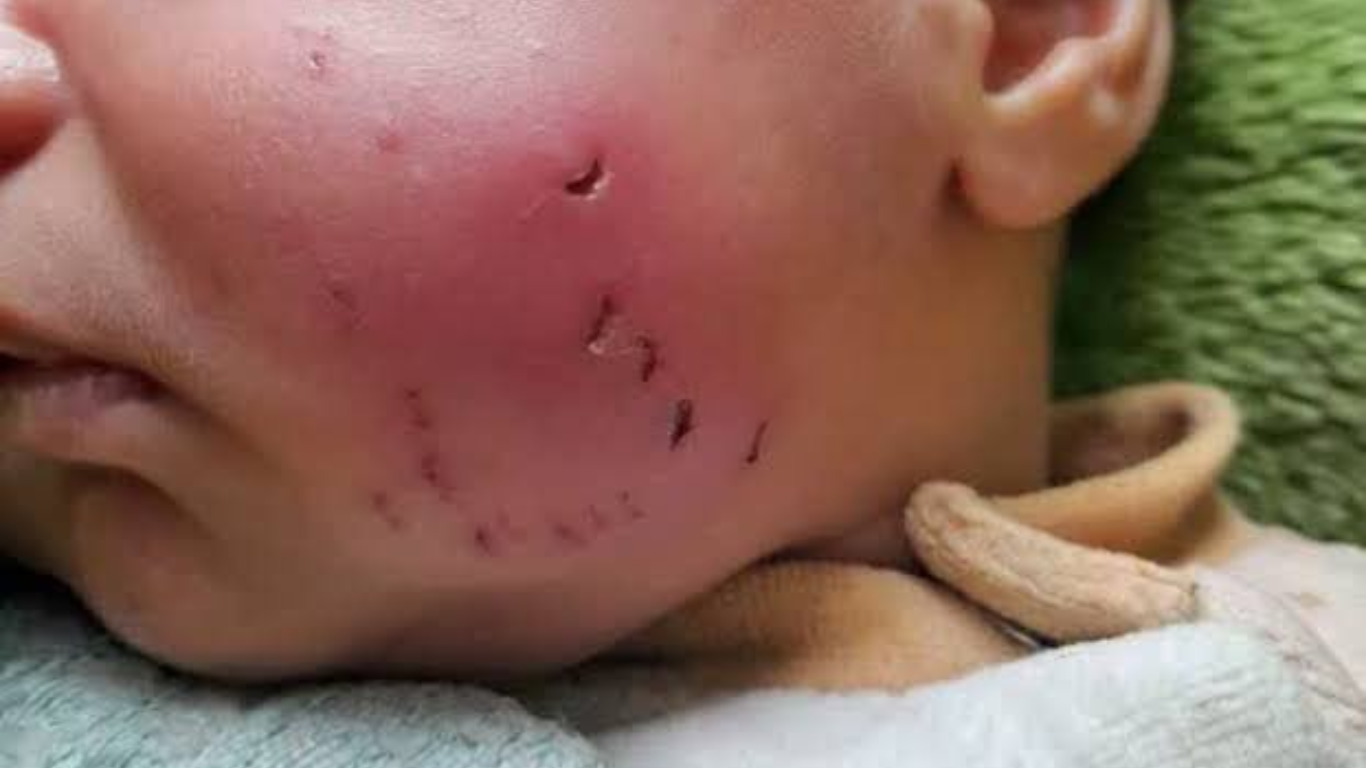 Ratas en Gaza intensifican crisis sanitaria y ponen en peligro la salud de miles de niñas y niños palestinos